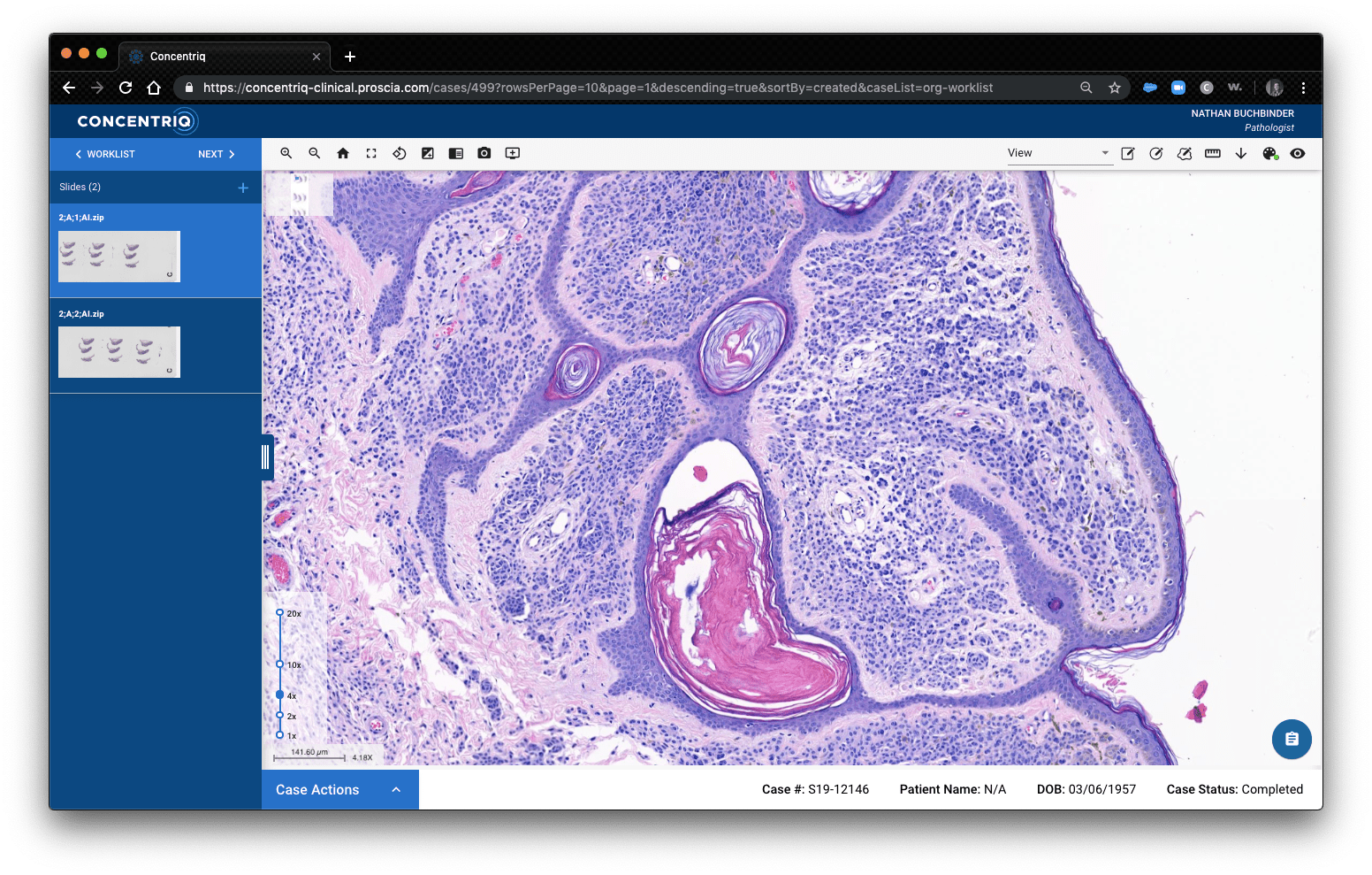 Innovative medical markers with bespoke packaging Scientist Live